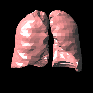 Fig.2 肺臓器の立体表示.