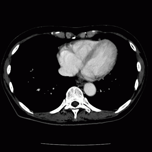 Fig.1 腹部X線CT画像．